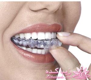 آیا برای متوقف کردن دندان قروچه، میتوان کاری انجام داد؟ 